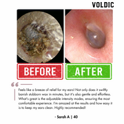 Voldic™ Electric Ear Wax Removal Kit  - Black Friday Sales