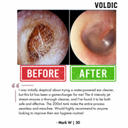 Voldic™ Electric Ear Wax Removal Kit