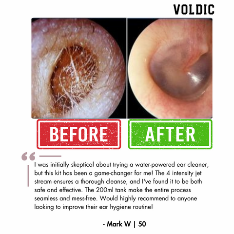 Voldic™ Electric Ear Wax Removal Kit  - Black Friday Sales