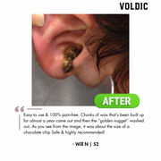 Voldic™ Electric Ear Wax Removal Kit