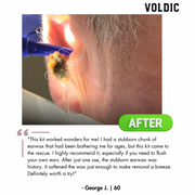 Voldic™ Electric Ear Wax Removal Kit  - Black Friday Sales